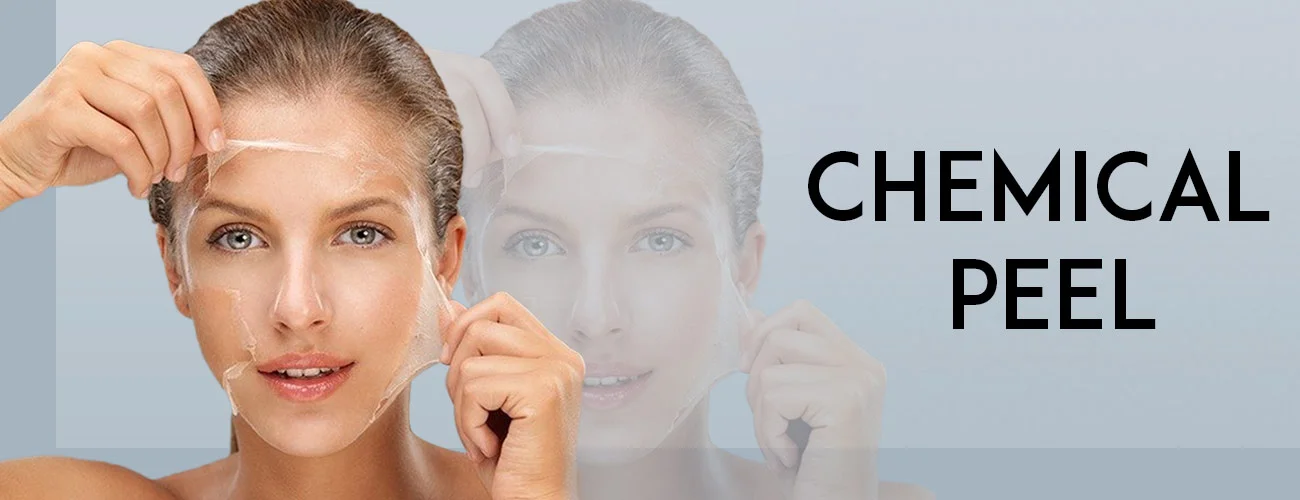 24-04-2022-chemical-peel-post-1