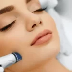 Everything About Microdermabrasion Services Murphy