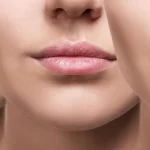 Lip Filler Touch-Ups