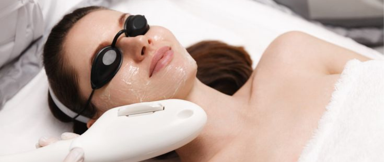 IPL Photofacial