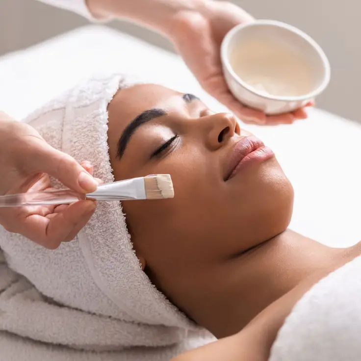 chemical peel