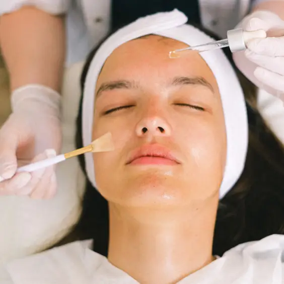 chemical peel