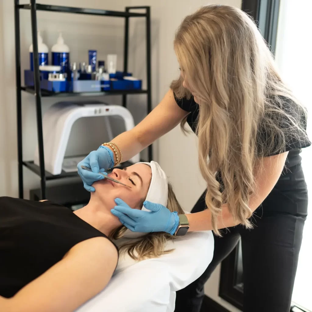 chemical peel