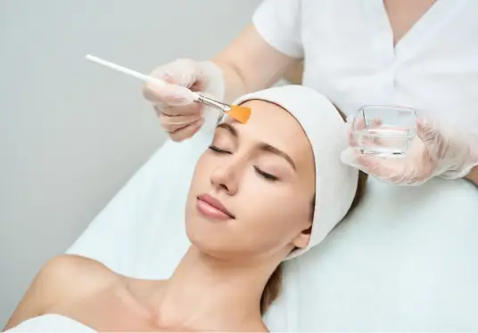 chemical peel