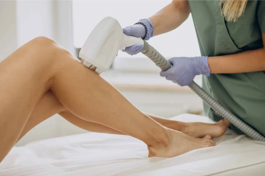 What to except from laser hair removal