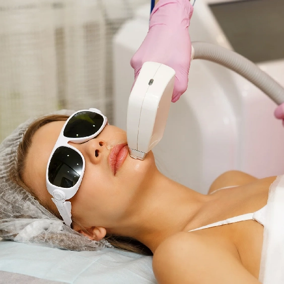 What is laser hair removal