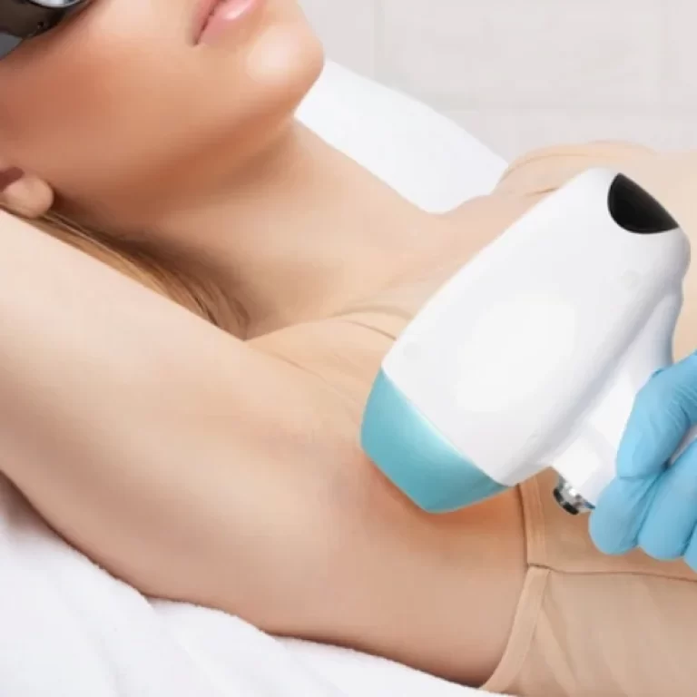 Laser-Hair-Removal
